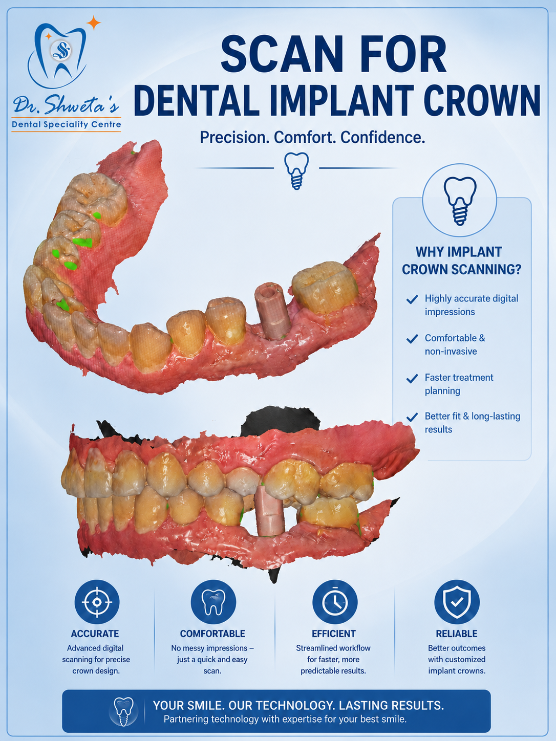 Digital implant crown scan taken at the clinic
